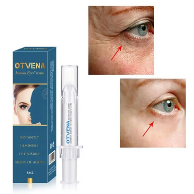 Crema Lift Instant, corectare a ridurilor adanci din jurul ochilor in 120 secunde, 8 ml, Otvena